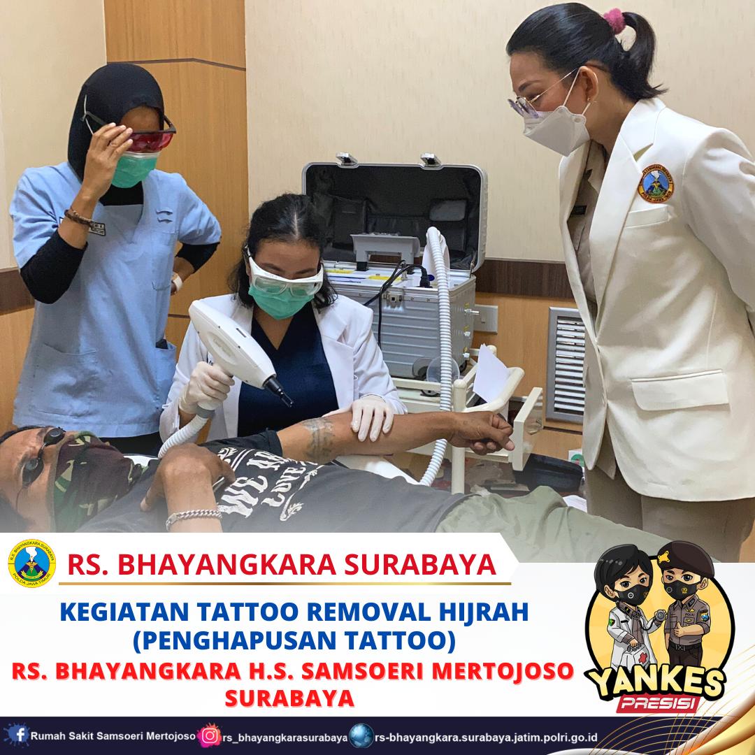 Rs Bhayangkara Surabaya Kegiatan Tattoo Removal Hijrah Hari Ke 1 Di Rs Bhayangkara Hs 